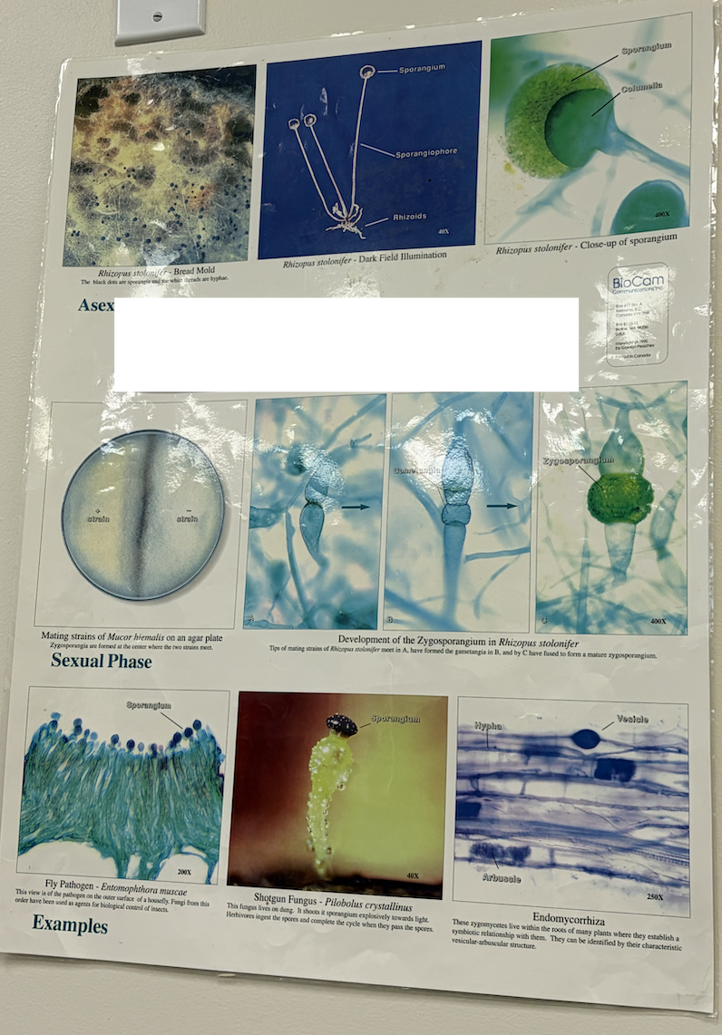 <p>What group of fungi is this?</p>