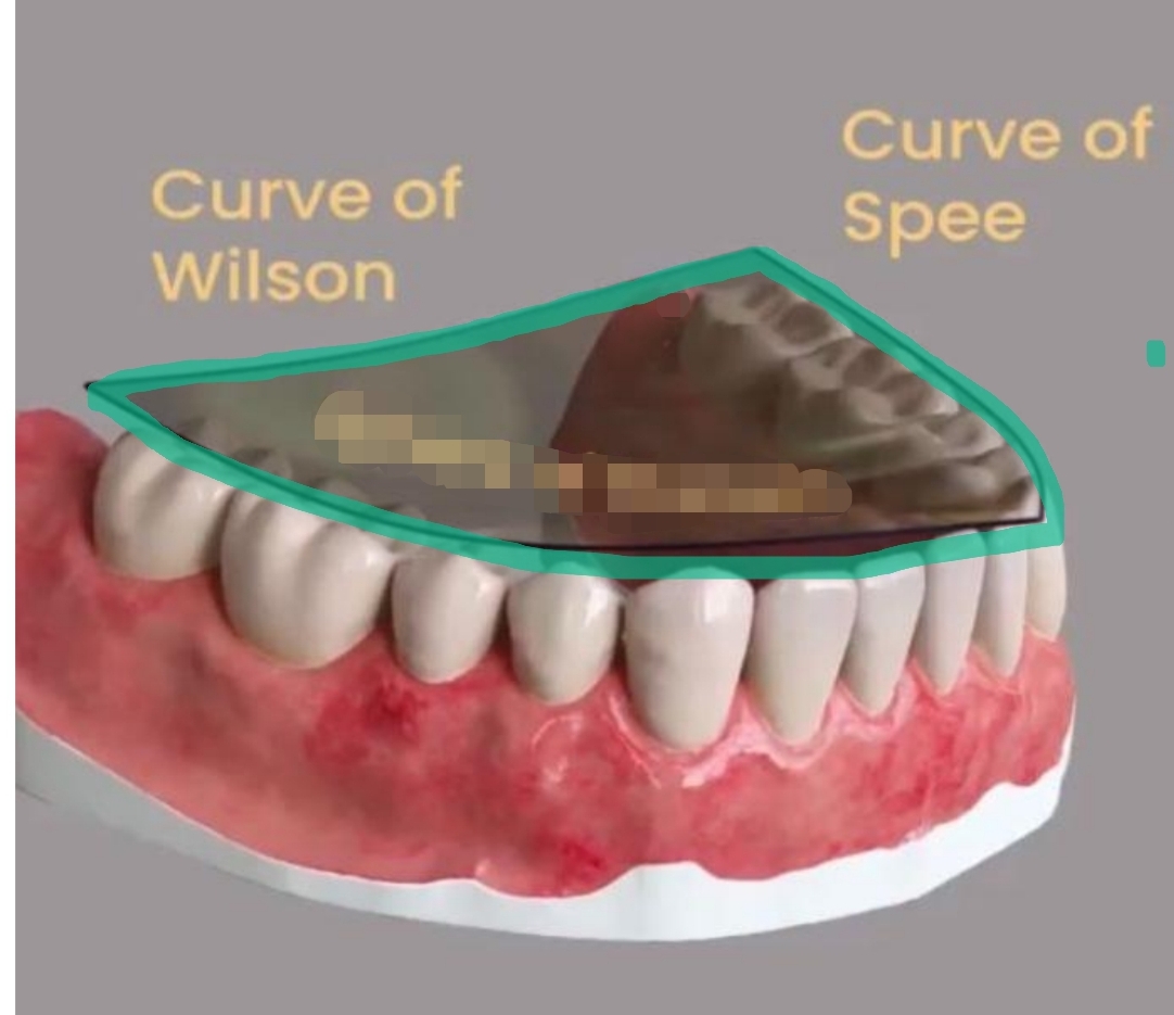 <ul><li><p>½ of a sphere</p></li><li><p>Combines Curve of Spee and Curve of Wilson</p></li><li><p>3-dimensional</p></li></ul><p></p>