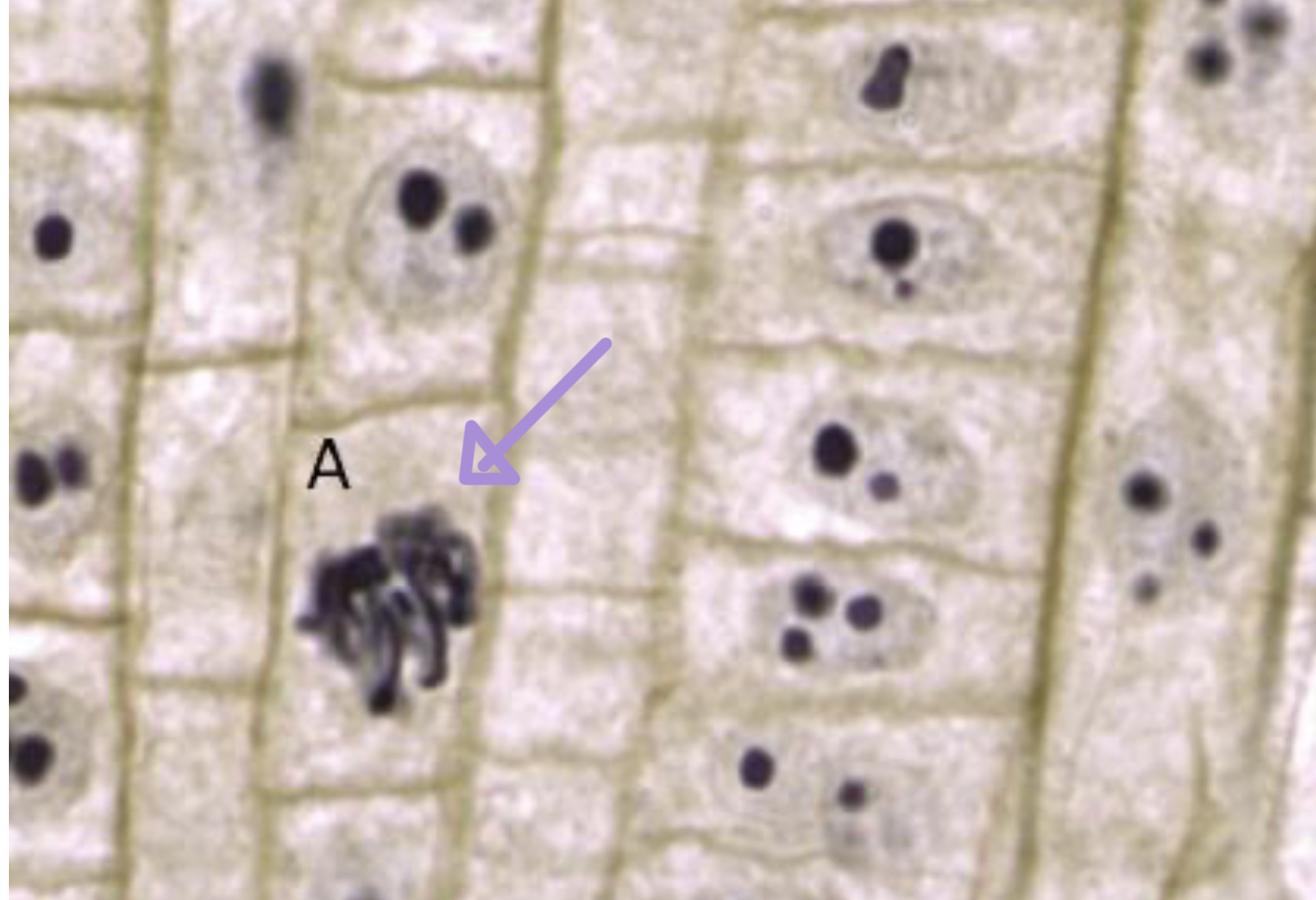 <p>what stage of cell division is this? </p>