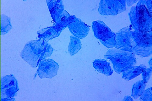 <p>What type of cells are these?</p>