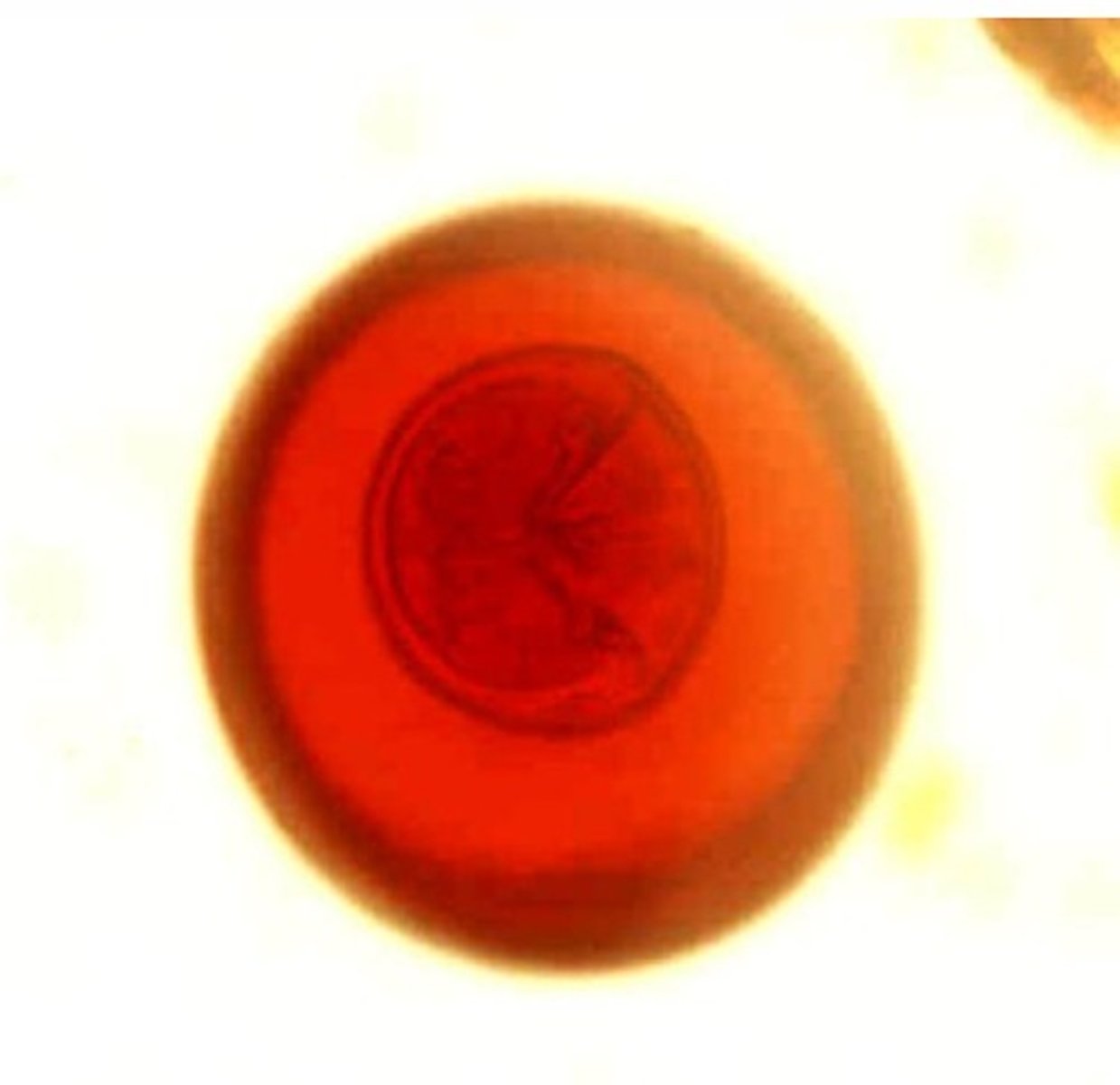 <p>Identify the parasite</p>