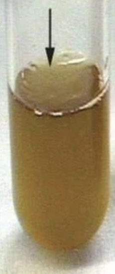 <p>Is this a positive or negative VP test?</p>