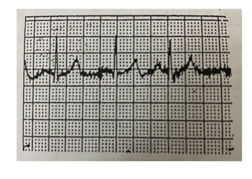 <p>What does this mean?</p>