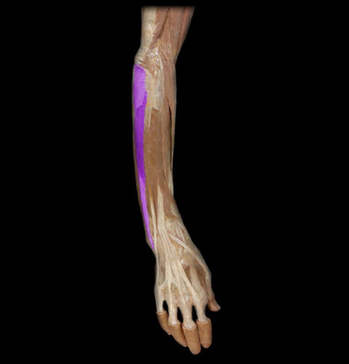 <p>- Origin = lateral epicondyle of the humerus</p><p>- Insertion = base of 5th metacarpal (runs pinky side)</p><p>- Primary Actions = wrist extension, ulnar deviation/flexion</p><p>- Innervation = radial nerve</p>