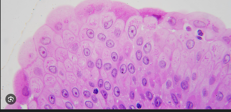 <ul><li><p><strong>Urinary bladder</strong> <span data-name="check_mark_button" data-type="emoji">✅</span> main site</p></li><li><p><strong>Ureters</strong></p></li><li><p><strong>Proximal part of the urethra</strong></p></li></ul><p></p>