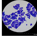 <p>what dye is used for simple staining </p>