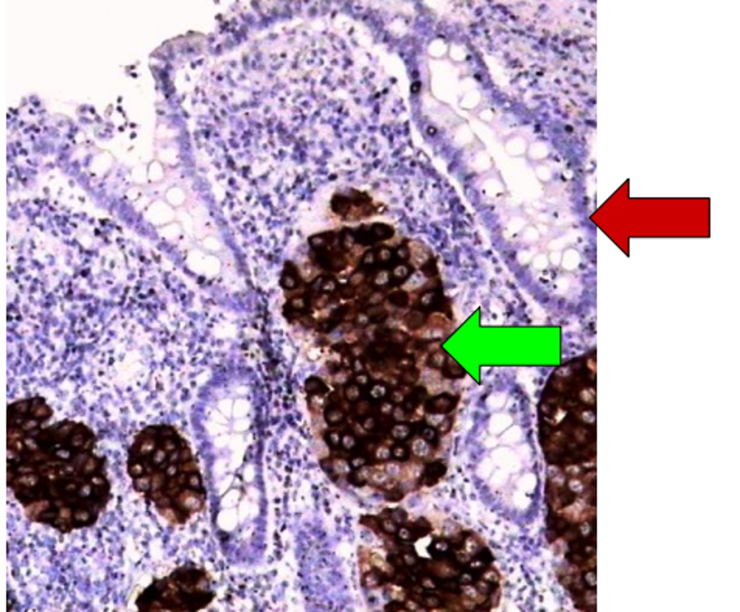 knowt flashcard image