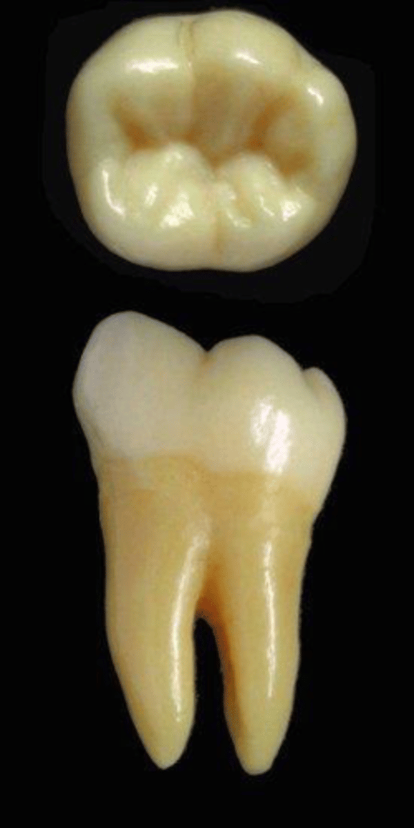 <p>what tooth is this &amp; why?</p>