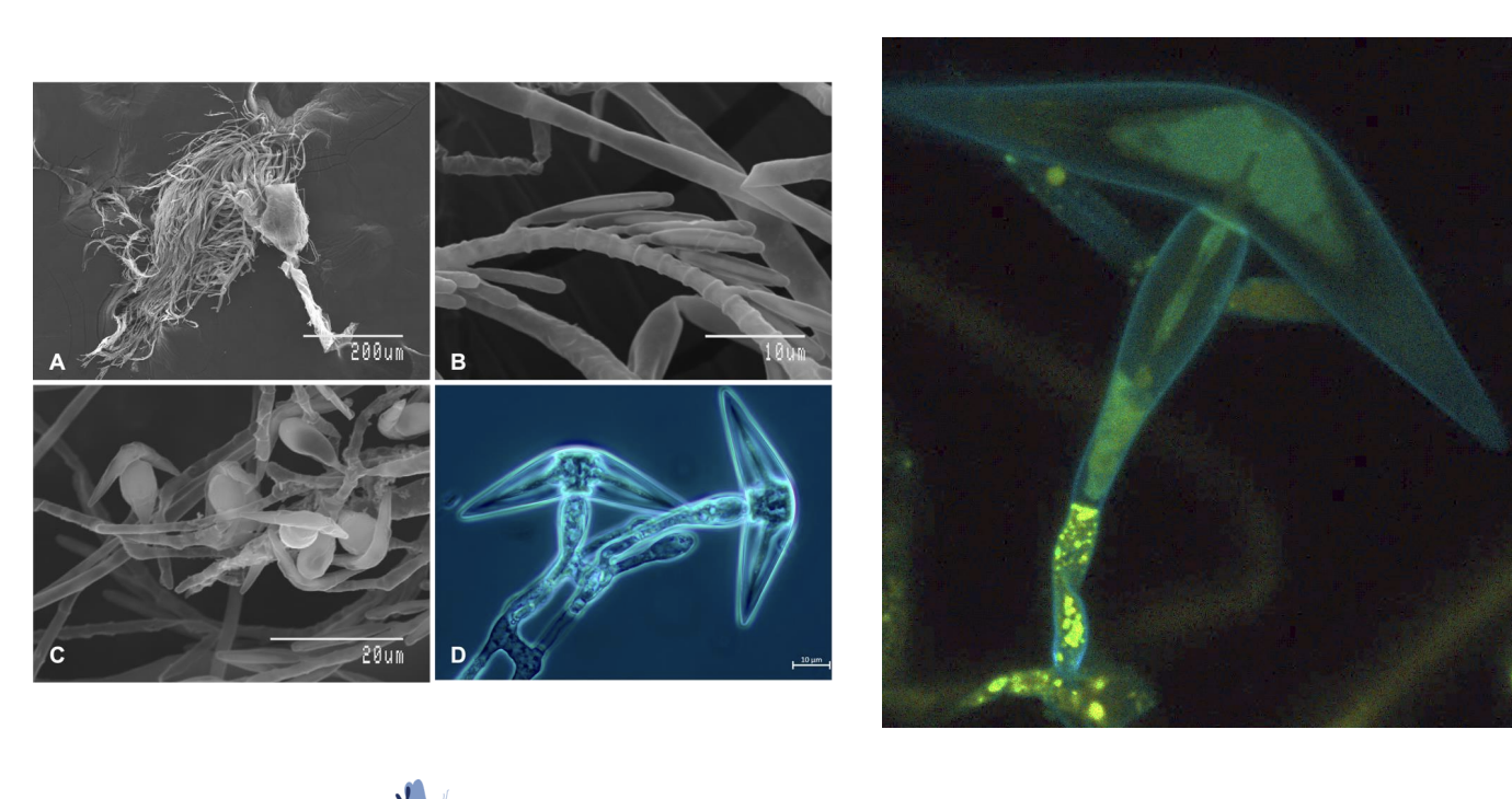 <ul><li><p><span style="background-color: inherit; line-height: 19.55px; color: windowtext;"><span>See fine details on surface and inside the cell</span></span><span style="line-height: 19.55px; color: windowtext;"><span>&nbsp;</span></span></p></li><li><p class="Paragraph SCXO192429150 BCX0" style="text-align: left;"><span style="background-color: inherit; line-height: 19.55px; color: windowtext;"><span>Right: study content inside the cell</span></span><span style="line-height: 19.55px; color: windowtext;"><span>&nbsp;</span></span></p><ul><li><p class="Paragraph SCXO192429150 BCX0" style="text-align: left;"><span style="background-color: inherit; line-height: 19.55px; color: windowtext;"><span>How nutrients transported</span></span><span style="line-height: 19.55px; color: windowtext;"><span>&nbsp;</span></span></p></li></ul></li></ul><p></p>
