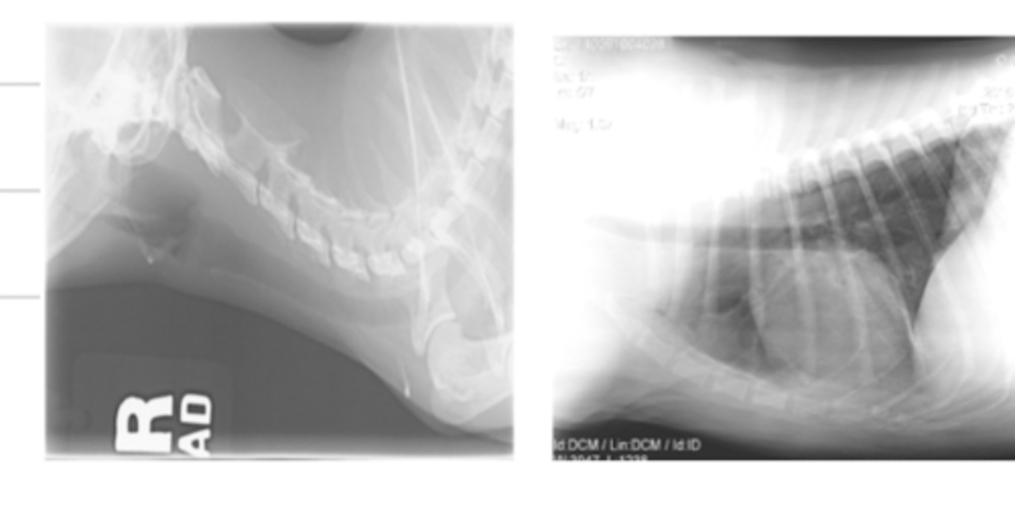 <p>a bright film, because of underexposure. when we decrease the kV, the xrays are not energetic enough to pass through tissues</p>
