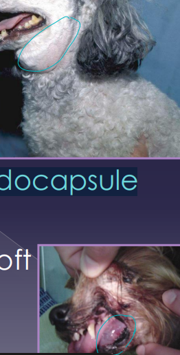 <ul><li><p><span style="color: rgb(136, 136, 136);"><strong>Et: </strong></span><strong><u>trauma</u></strong>, sialoliths, FB, neoplasia, dental extraction, Sx</p></li><li><p><span style="color: rgb(136, 136, 136);"><strong>Sig: </strong></span>GSD, Silky Terrier, Dachshund, Poodle</p><ul><li><p><strong>Main</strong>:&nbsp;Parotid, Mandibular, Sublingual, Zygomatic</p></li></ul></li></ul><ul><li><p><span style="color: rgb(136, 136, 136);"><strong>Cs: </strong></span>saliva collects in<strong> pseudocapsule, soft tissue swelling</strong></p><ul><li><p><strong>Cervical (#1):</strong> soft, fluctuant, <u>non-painful swelling ventral to mandible</u></p></li><li><p><strong>Sublingual (ranula):</strong> <u>swelling under tongue</u>, halitosis, dysphagia, oral bleeding</p></li><li><p><strong>Pharyngeal: </strong><u>intraoral swelling into pharynx</u>, cough, dyspnea, stridor</p></li><li><p><strong>Zygomatic: </strong><u>exophthalmos, 3rd eyelid protrusion</u>, orbital swelling</p></li></ul></li></ul><ul><li><p><span style="color: rgb(136, 136, 136);"><strong>Dt: </strong></span>FNA w/ stringy fluid, non-degenerate neutrophils, macrophages</p></li></ul><img src="https://knowt-user-attachments.s3.amazonaws.com/263d8e9c-9e7f-4b5a-a3d0-01ce6c68eddf.png" data-width="25%" data-align="center"><ul><li><p><span style="color: rgb(136, 136, 136);"><strong>Tx: </strong></span><strong><u>Sx excision of both glands + duct (mandibular + sublingual),</u></strong> marsupialization (pharyngeal/ranula)</p><ul><li><p>excellent prognosis, but recurrence and <strong><u>infection</u></strong> possible</p></li><li><p><u>Rx management unsuccessful</u></p></li></ul></li></ul><img src="https://knowt-user-attachments.s3.amazonaws.com/5fb8859f-78d3-44d5-8f7b-536f94f292be.png" data-width="50%" data-align="center"><p></p>
