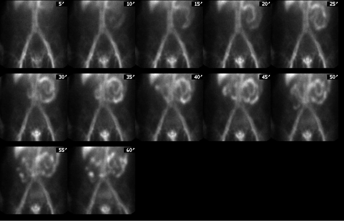 <p>is this using Tc-RBC’s or Tc-SC?</p>