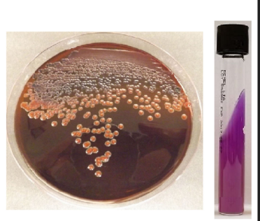 <p>How are the colonies of this organism typically described? (Answer the description only. Do not include the word "colonies" or "colony")</p>
