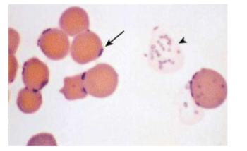 <p><span style="color: rgb(255, 252, 252);"><span>INTRAcellular parasitic bacterium – cannot live outside red blood cells;&nbsp;</span></span><span style="color: transparent;"><span>Appears as </span></span><span style="color: rgb(255, 252, 252);"><span>coccoid, rod-shaped, or ringlike bacteria on RBCs, usually on the periphery</span></span></p>