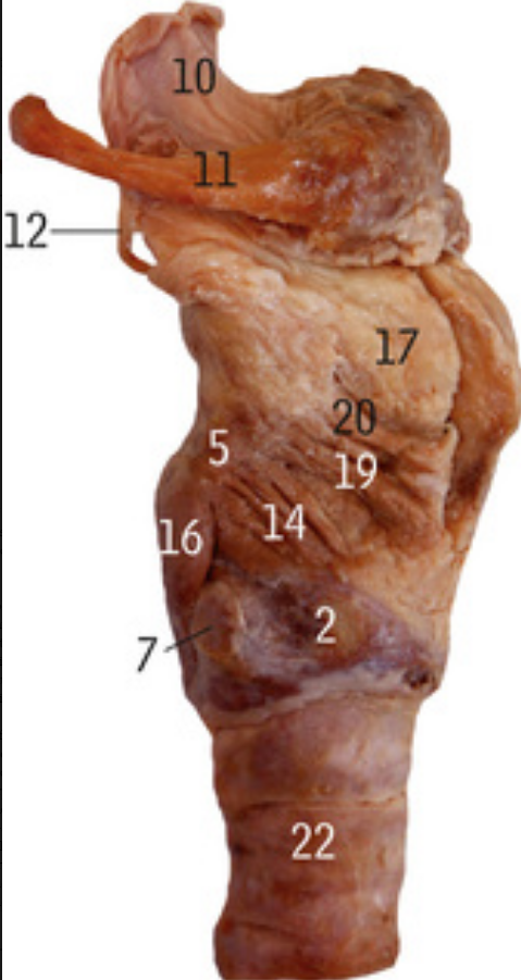 <p>What is 22</p>