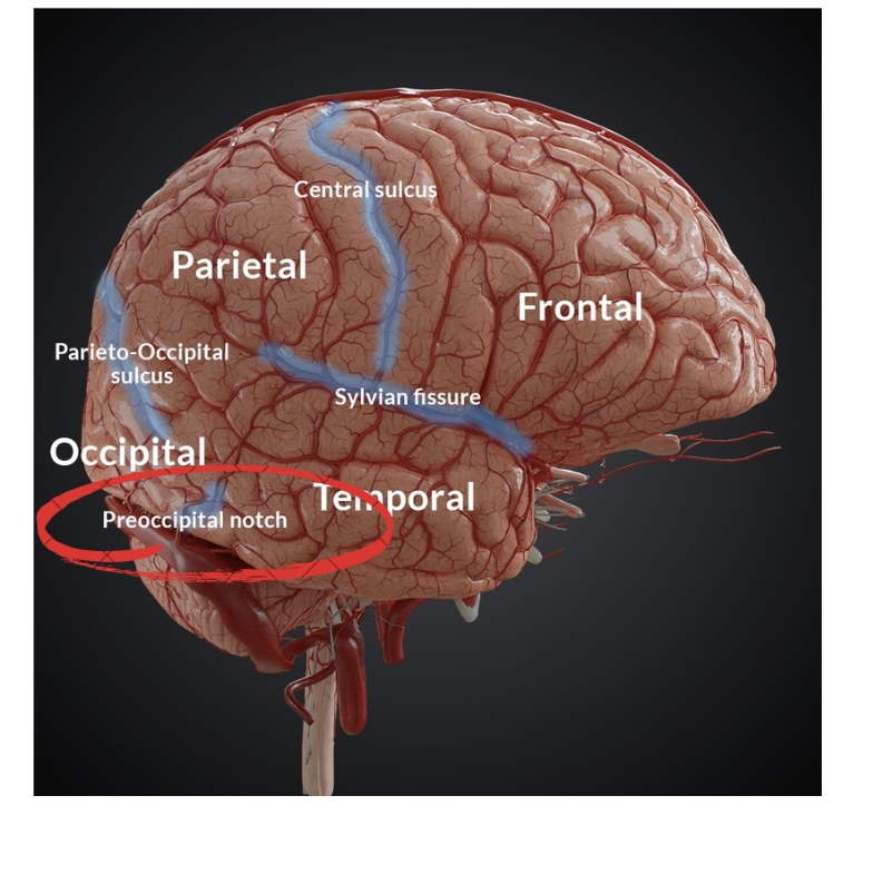 <p>the preoccipital notch does what?</p>