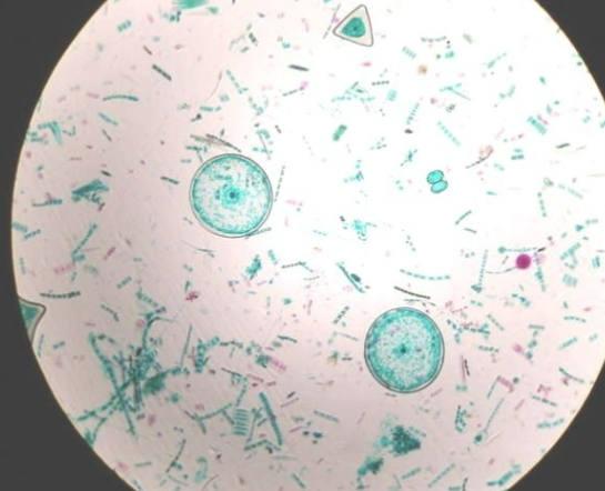 <p>Free-floating</p>