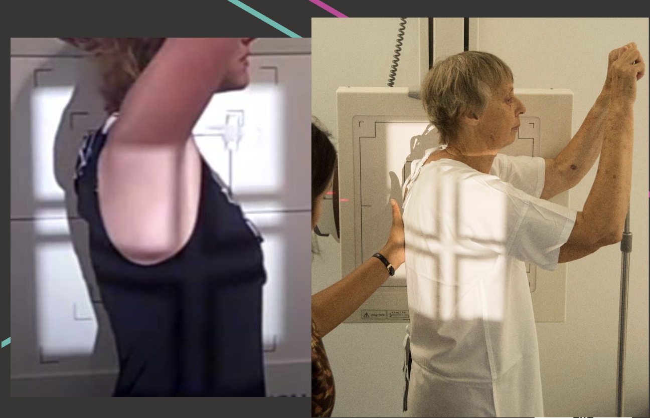 <p>Broad FS, 180cm</p><p>110kVp/8mAs</p><p>Straight tube</p><p>CR: Base of scapula at mid-axillary line</p>