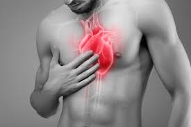 <p>heart attack (đau tim)</p>