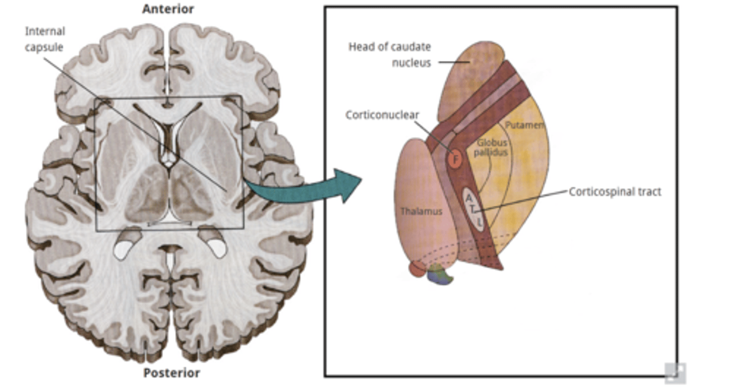 <p>-Contralateral loss of voluntary movement</p><p>-Contralateral decreased automatic movement control</p><p>-Contralateral loss of conscious somatosensation</p><p>-Visual &amp; auditory radiations</p>