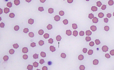 <p>from queen to kitten although it is unclear how&nbsp;</p>