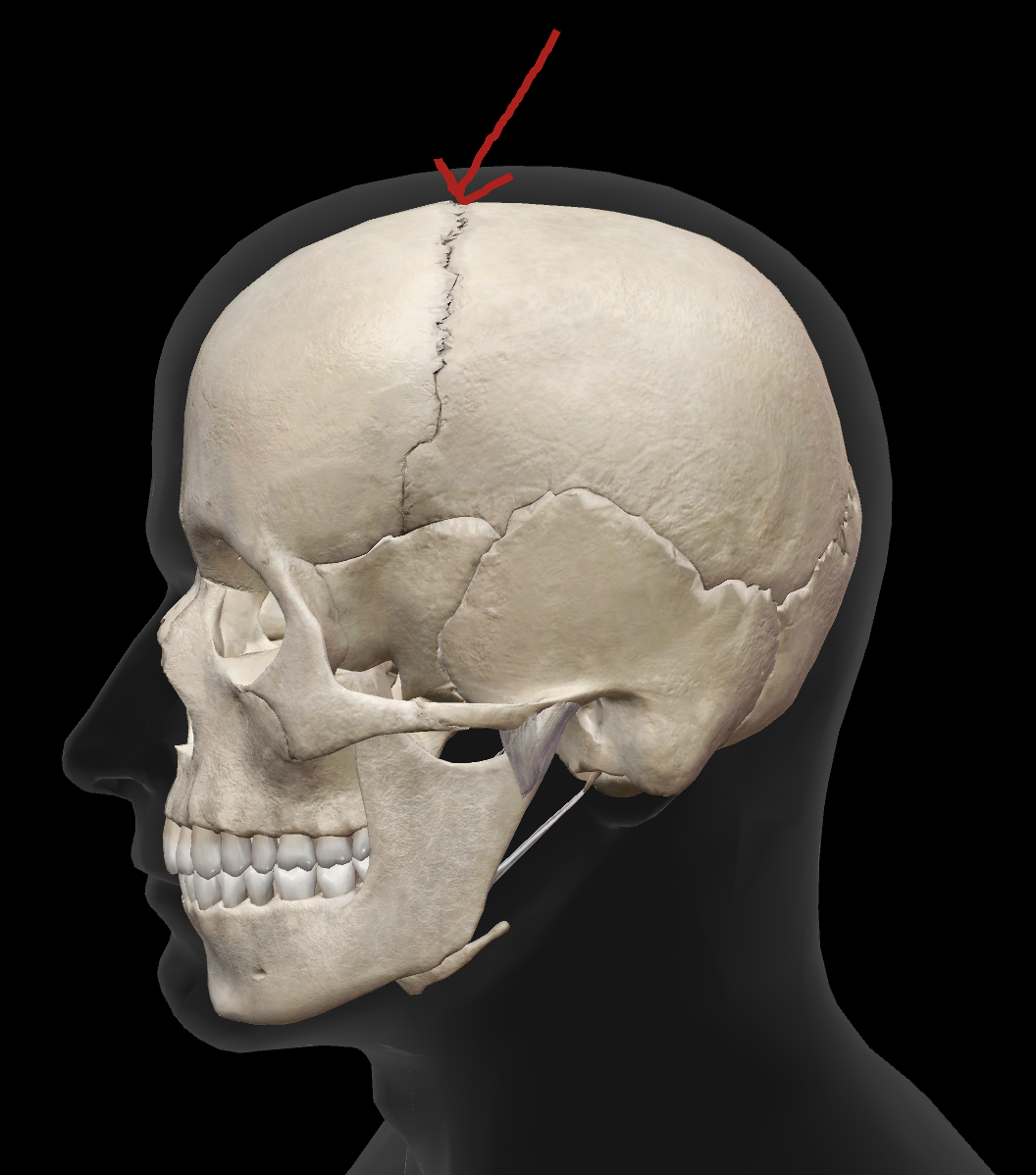 <p>What is the name of this suture?</p>