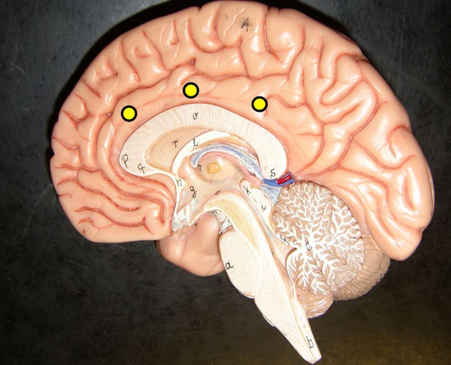 knowt flashcard image