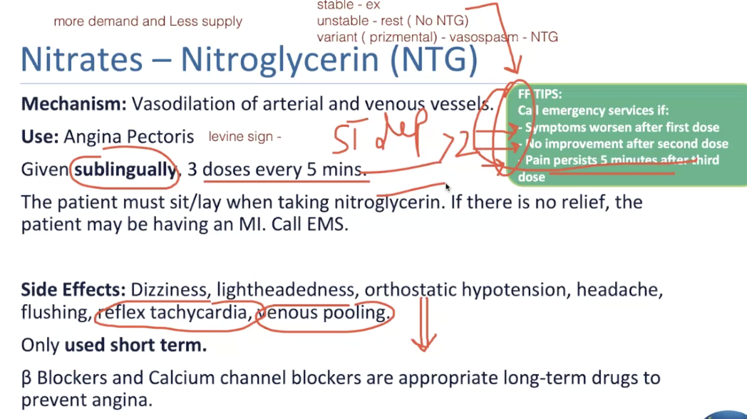 <ol><li><p>symptoms worsen after first dose</p></li><li><p>no improvement after second dose</p></li><li><p>pain persists 5 minutes after third dose</p></li></ol><p>because if they are not getting better, the patient is experiencing UNstable angina and may go into MI</p><ul><li><p>if going through ischemia/MI, the ECG will appear as ST depression >2mm</p></li></ul><p></p>