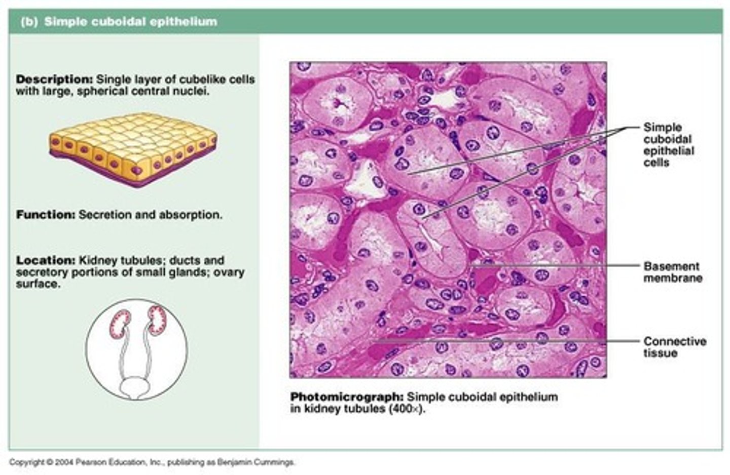 <p>Part of a nephron, where initial filtration occurs and is lined with simple squamous cells.</p>