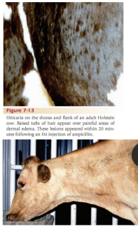<p><span>Urticaria and Angioedema</span></p>