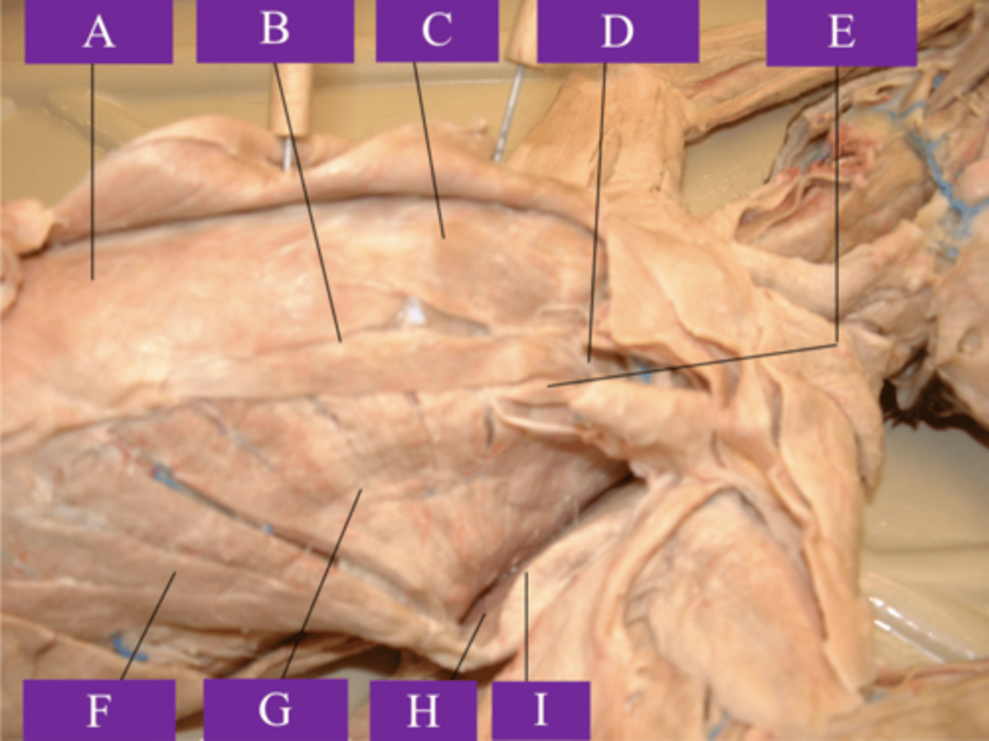 <p>What is letter H?</p>
