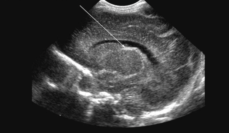 <p>What is the arrow pointing to?</p>