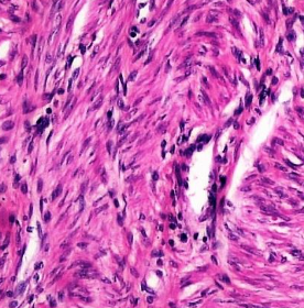 <p><span>Identify this muscle tissue, its location, and its function.</span></p>