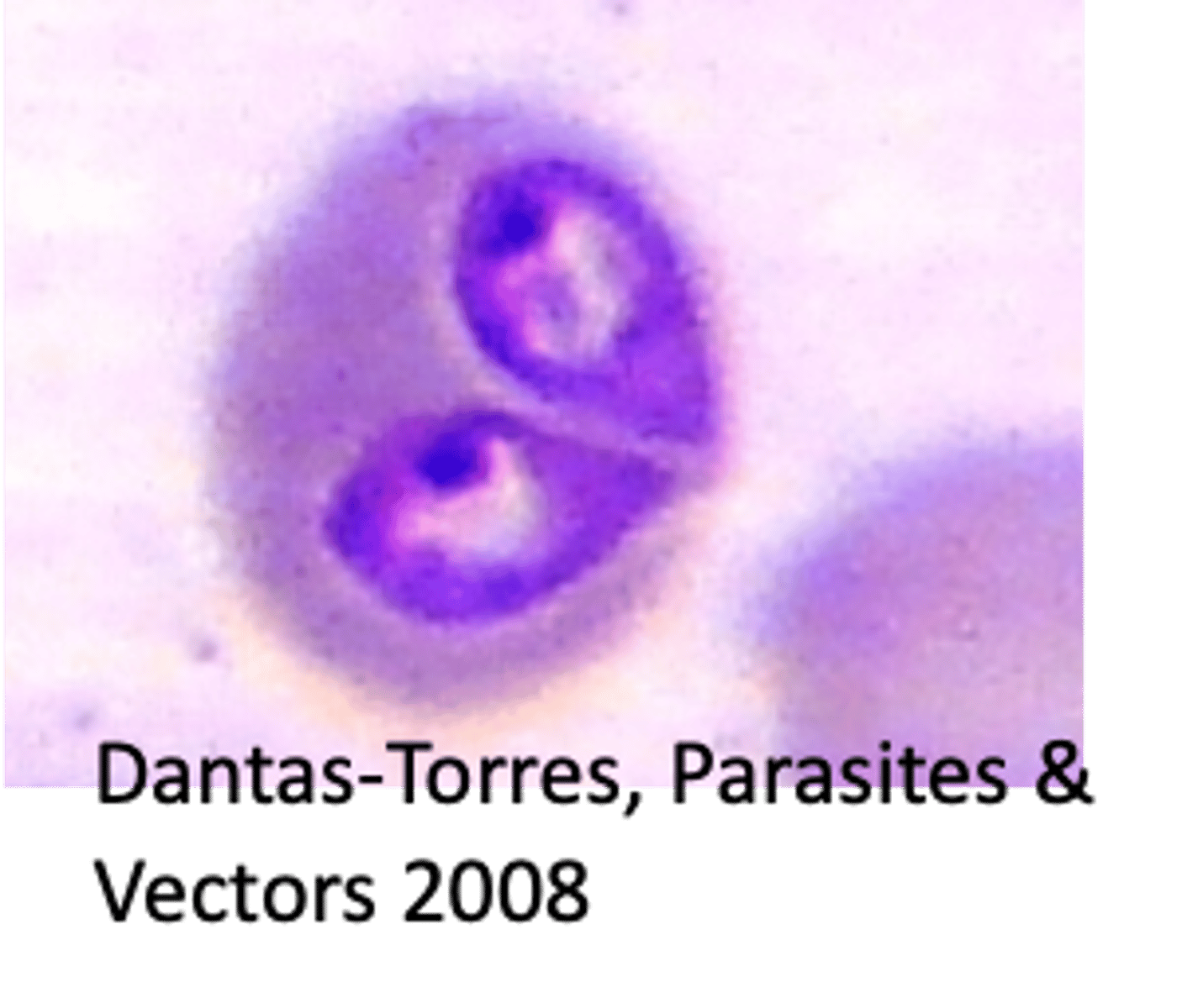<p>What Babesia spp. is this? How do you know?</p>