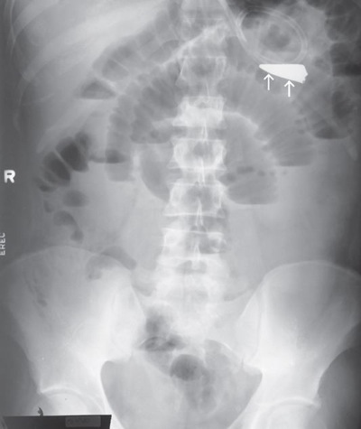 <p>What position is demonstrated?</p>