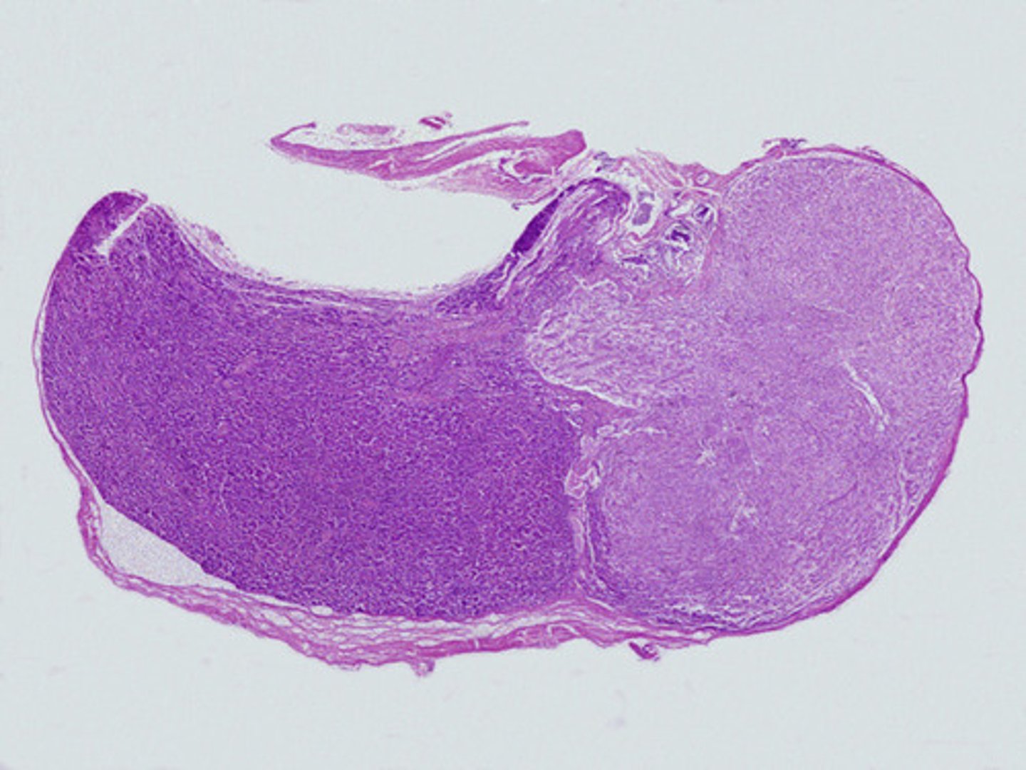 <p>entire gland, glandular tissue on the left and nervous tissue on the right.</p>
