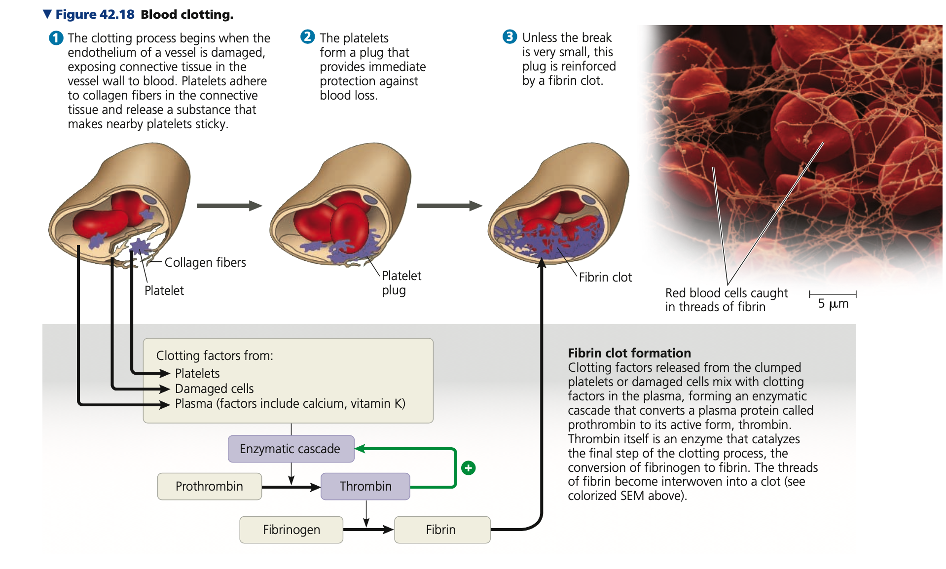 <p><strong>Blood clotting</strong></p><ul><li><p>Platelets function in blood clotting</p></li><li><p>When the endothelium of a blood vessel is damaged, clotting mechanism begins</p></li><li><p>Cascade of complex reactions converts ______ to fibrin, forming a clot</p></li><li><p>A blood clot formed within a blood vessel is</p><p>called a ______</p><ul><li><p>Can block blood flow</p></li></ul></li></ul>