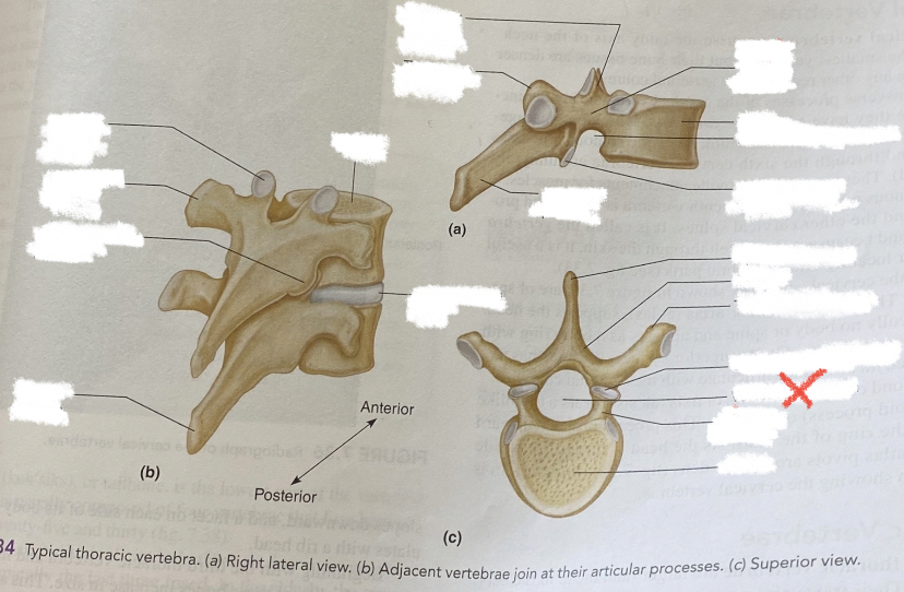 spinal cord here
