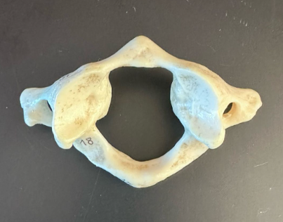 <p>What is this bone?</p>