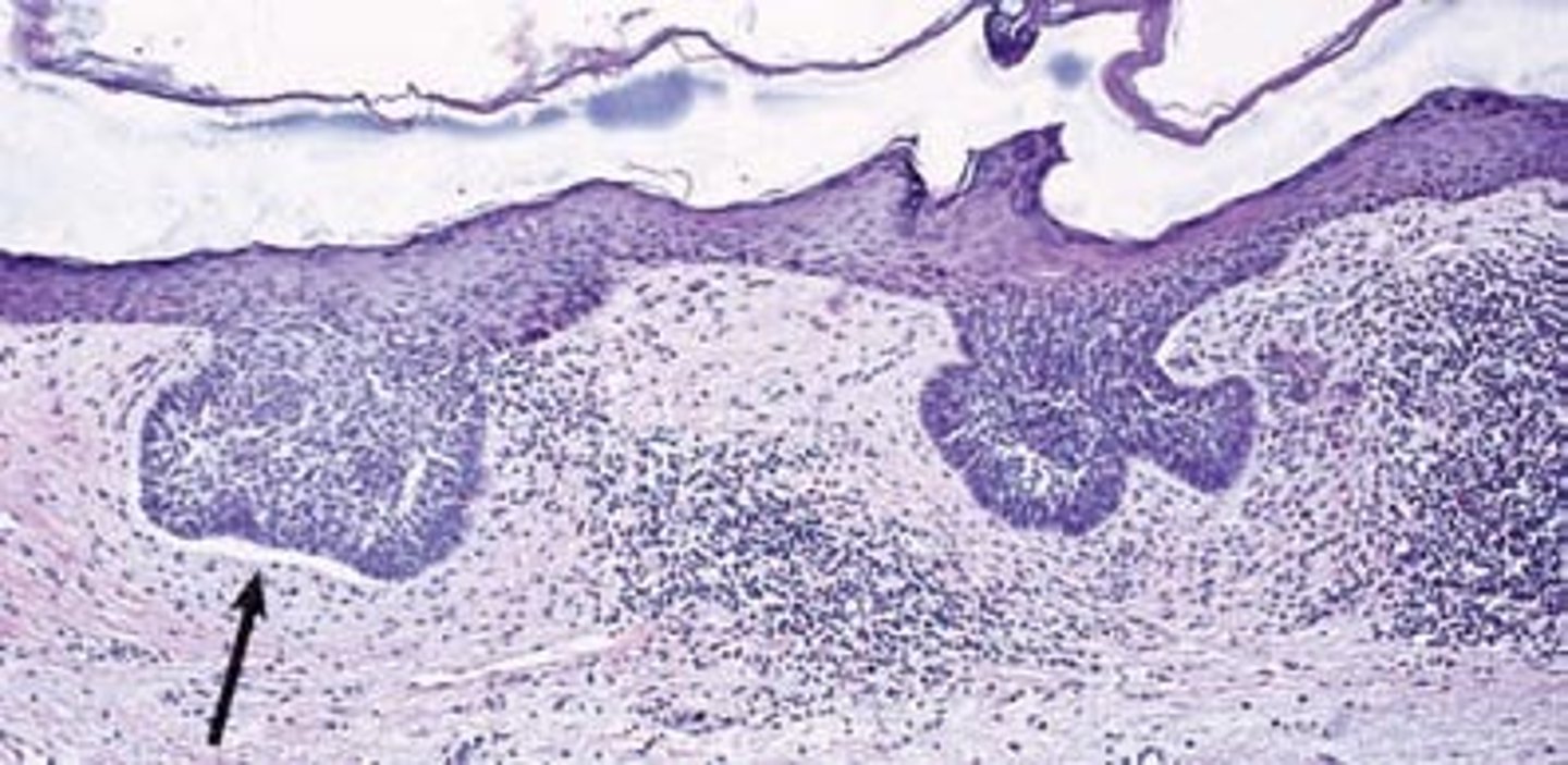 <p>surface attached to underlying tissue; provide nutrient exchange.</p>