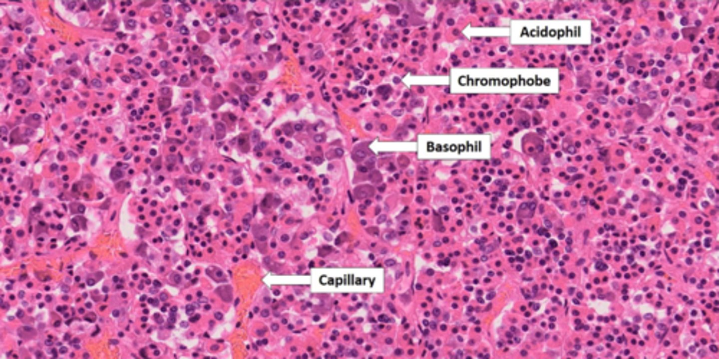 <p>glandular tissue that secretes: ACTH, PRL, GH, TSH, FSH, LH</p>