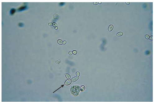 <p><span style="font-family: MyriadPro-Light;">Yeast</span></p>