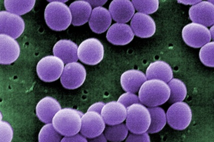 <p>streptococcus, staphylococcus, or diplococcus?</p>