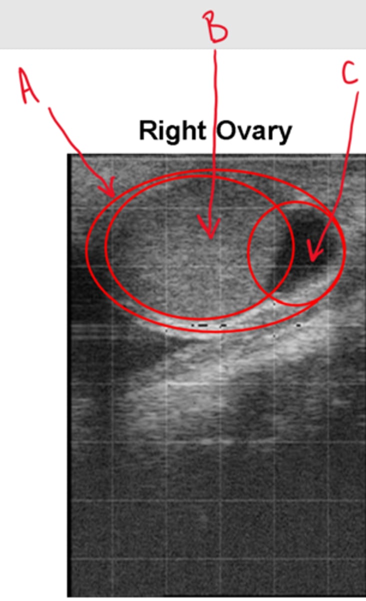 <p>Label this ultrasound of the right ovary</p>