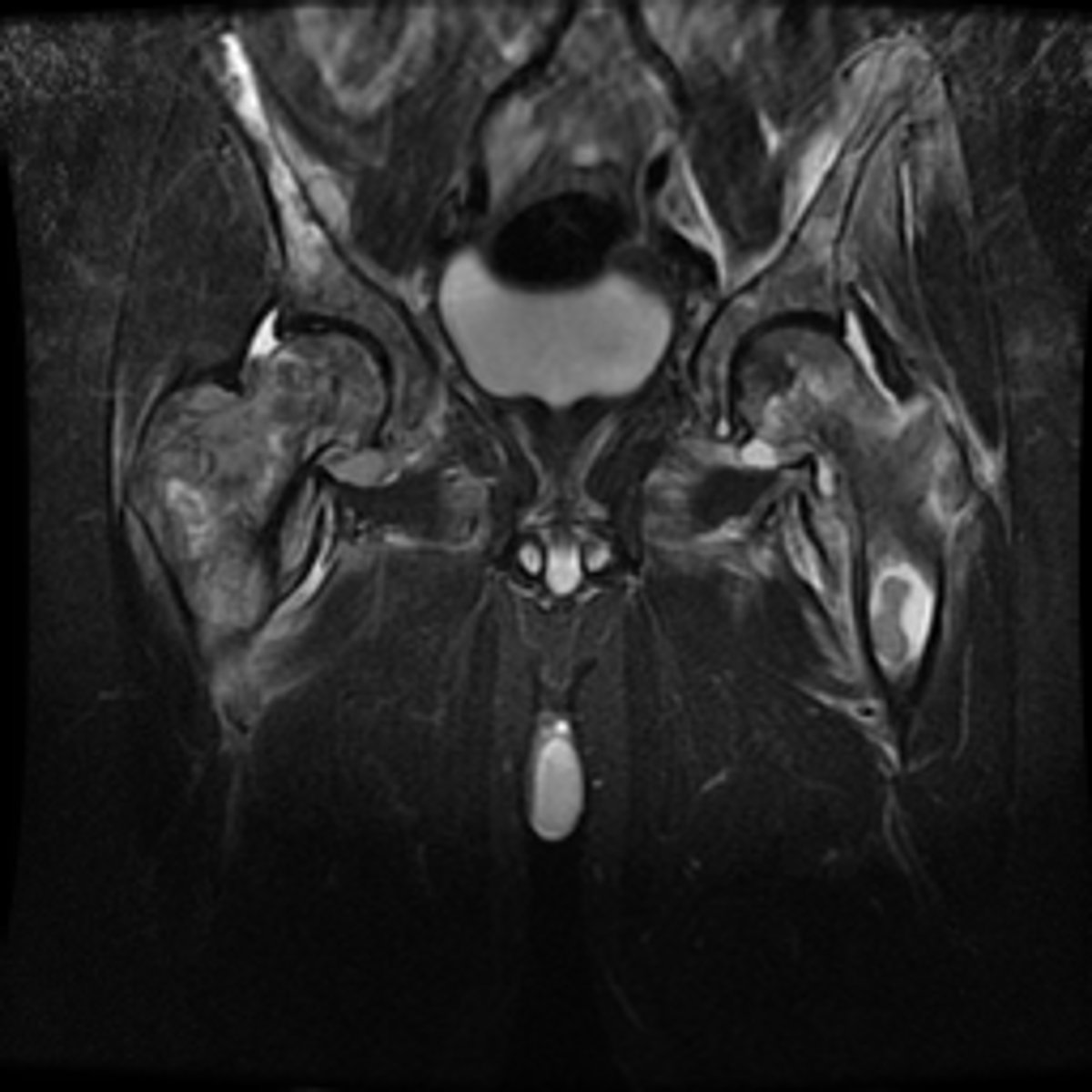 <p>What bone(s) is/are involved?</p>