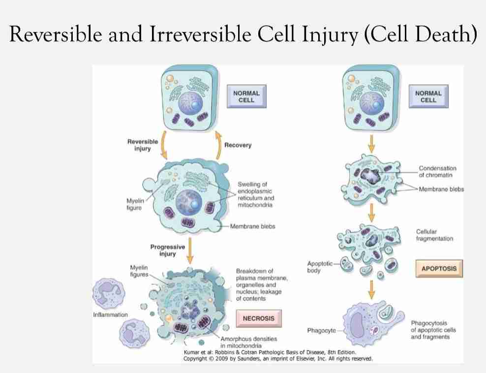 <p>Reversible:</p><ul><li><p>Characterized by generalized swelling of cell and it's organelles </p></li><li><p>Blebbing of plasma membrane, detachment of ribosomes from endoplasmic reticulum &amp; clumping of nuclear chromatin </p></li></ul><ul><li><p>Hallmark include:-l</p></li></ul><ul><li><p>Reduced oxidative phosphorylation with reduced ATP</p></li><li><p>Cellular swelling caused by changes in ion concentration &amp; water influx</p></li><li><p>Changes in mitochondria &amp; other organelles</p></li></ul><p>Irreversible :</p><ul><li><p><span style="color: var(--color-neutral-black)">Characterized by increasing swelling of cell; swelling &amp; disruption of lysosomes, presence of large amorphous densities in swollen mitochondria, disruption of cellular membranes &amp; profund nuclear changes </span></p></li><li><p><span style="color: var(--color-neutral-black)">Latter include nuclear condensation (pyknosis), followed by fragmentation (karyorrhexis)&amp; dissolution of nucleus (karyolysis)</span></p></li><li><p><span style="color: var(--color-neutral-black)">Laminated structure (myelin figures) derived from damaged membranes of organelles &amp; plasma membrane first appear during reversible stage &amp; become more pronounced in irreversible damaged cells</span></p></li></ul><ul><li><p>Necrosis &amp; apoptosis</p></li></ul>