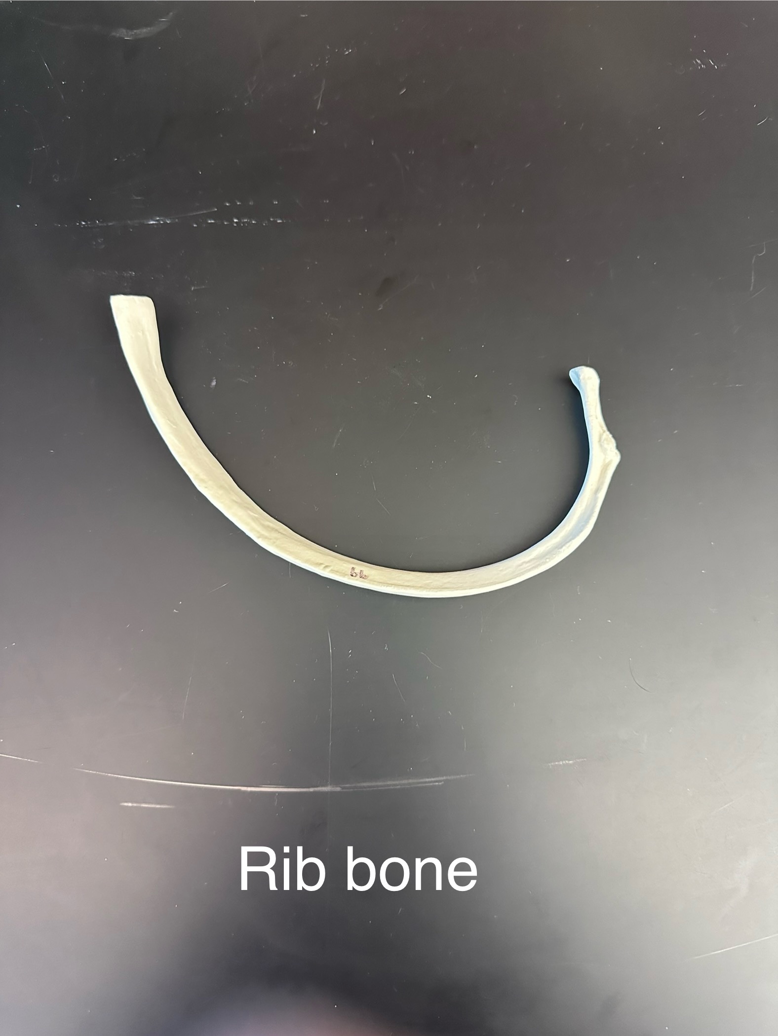<p>Rib bone</p>