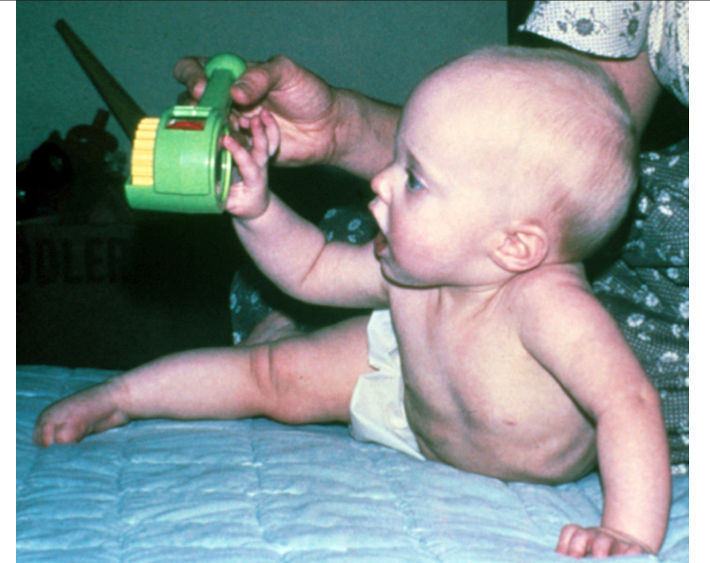<p>what quarter of life is this infant demonstrating?</p>