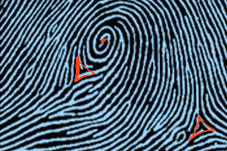 <p>central pocket whorl, two deltas, one core</p>