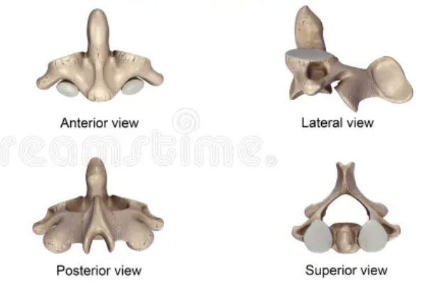 <p>What vertebrae is this?</p>